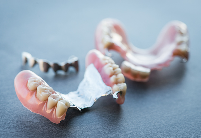 メタル床義歯について